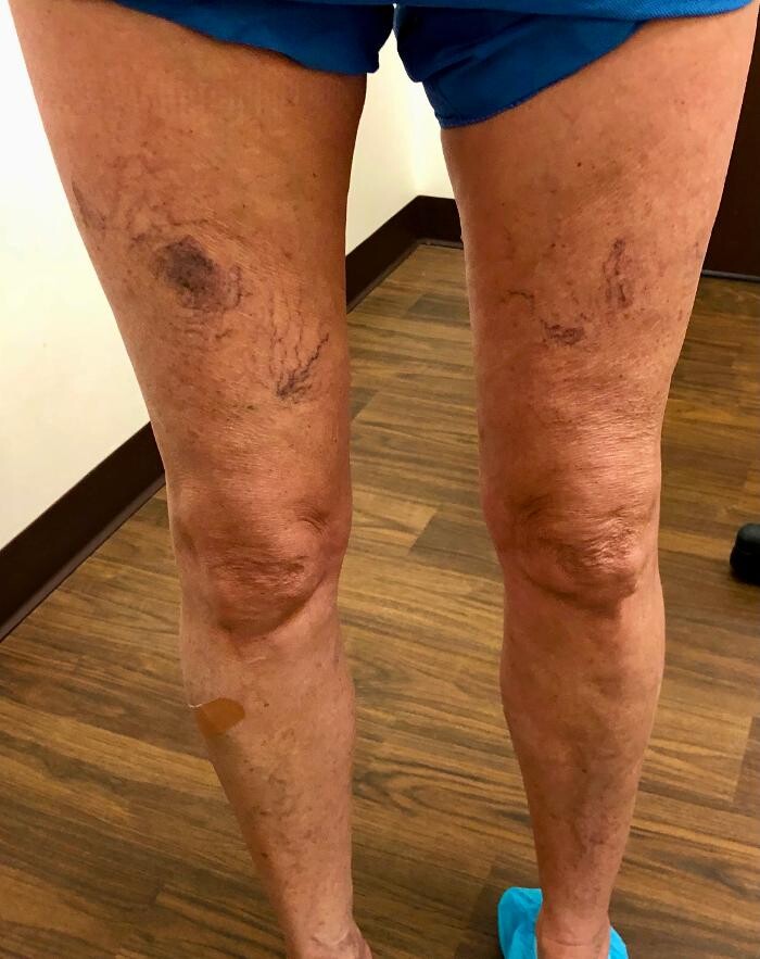 Images Fort Worth Vein Center | Dr. Barry Oswalt, now part of CVR