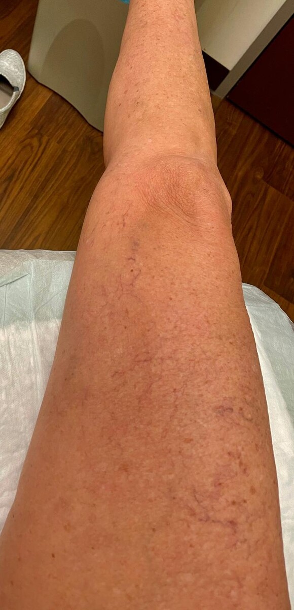 Images Fort Worth Vein Center | Dr. Barry Oswalt, now part of CVR