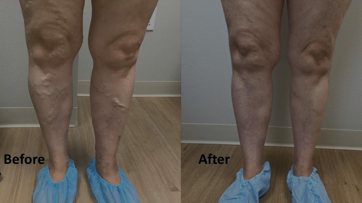 Images Fort Worth Vein Center | Dr. Barry Oswalt, now part of CVR