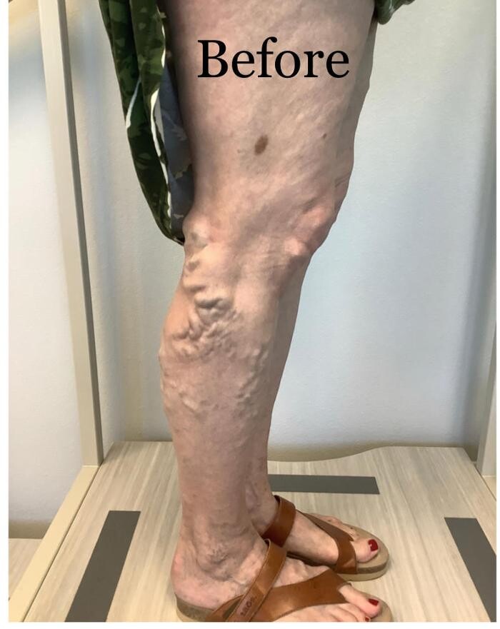 Images Fort Worth Vein Center | Dr. Barry Oswalt, now part of CVR