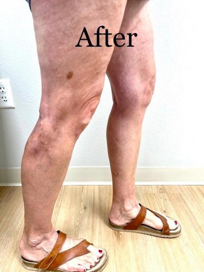 Images Fort Worth Vein Center | Dr. Barry Oswalt, now part of CVR