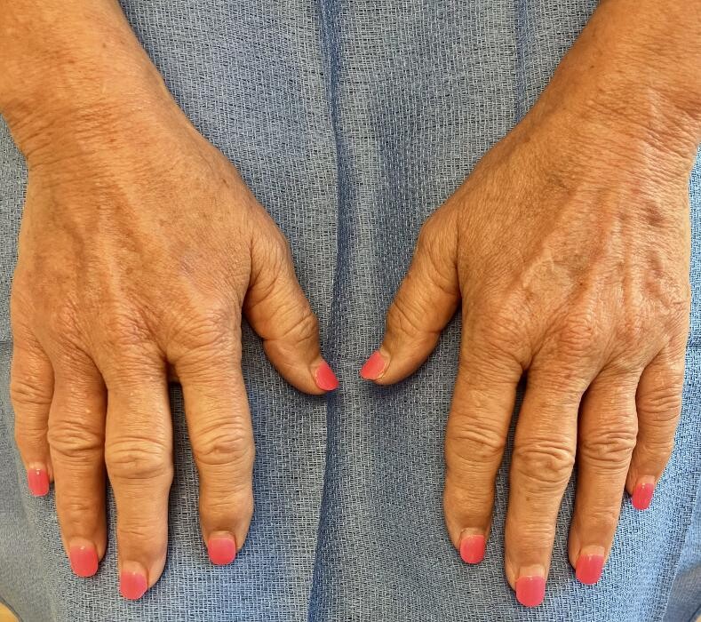 Images Fort Worth Vein Center | Dr. Barry Oswalt, now part of CVR