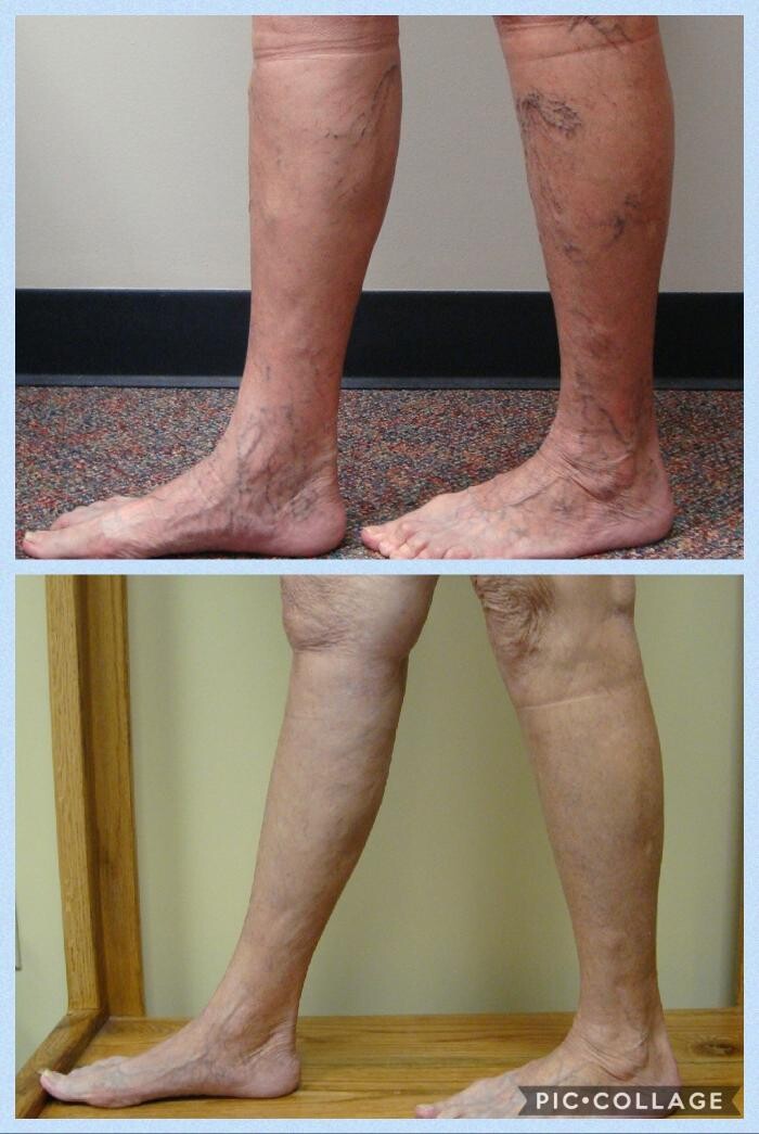 Images Vein Specialists of the Carolinas: Dr. David G. Draughn, now part of CVR