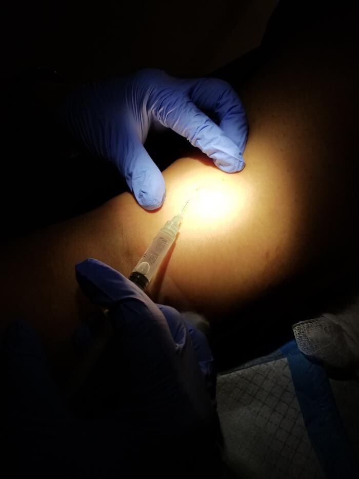 Images Center for Vein Restoration | Dr. Frank Sbrocco