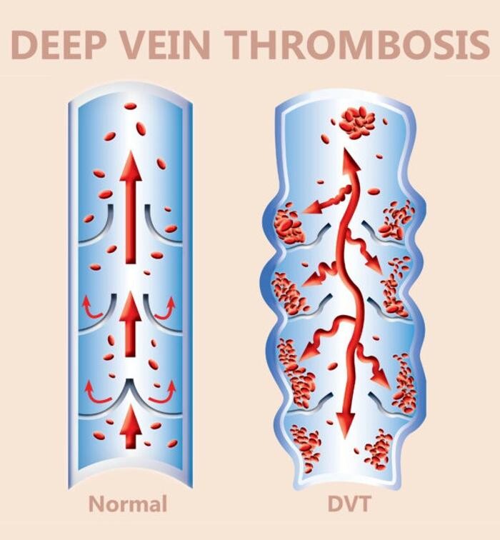 Images Vein Specialists of the Carolinas: Dr. David G. Draughn, now part of CVR