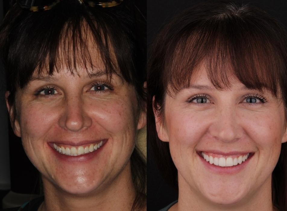 Images Dr. Bianca Clark