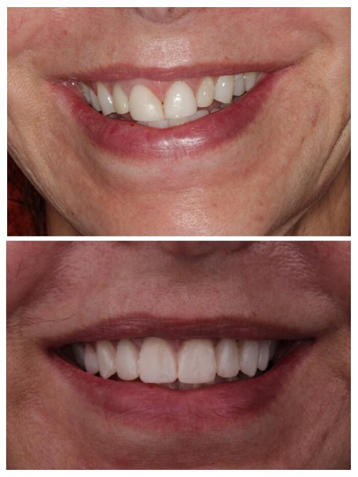 Images Dr. Bianca Clark