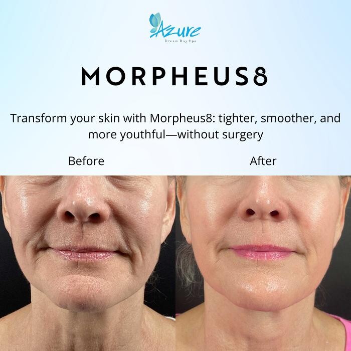 Images Azure Dream Med Spa