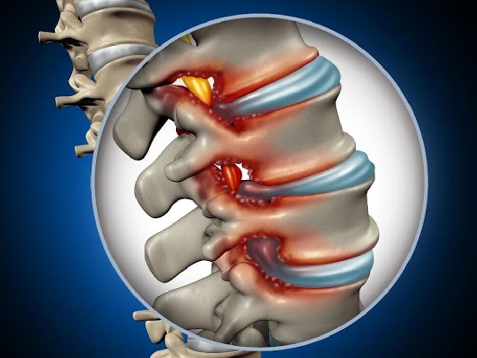 Images Gallagher and Hagopian