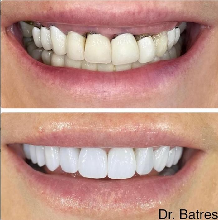 Images Super Dentist Miami