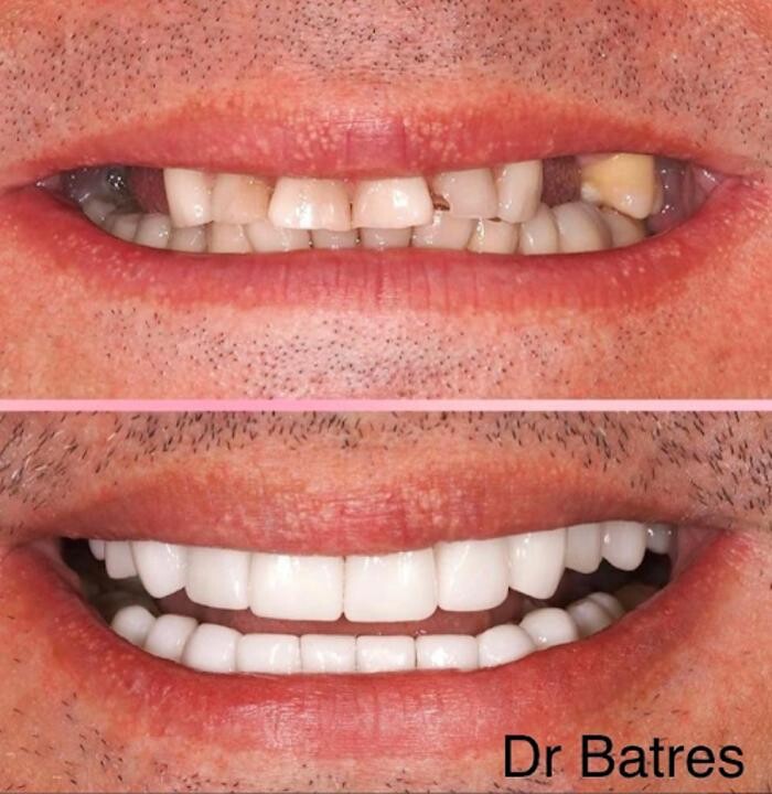 Images Super Dentist Miami