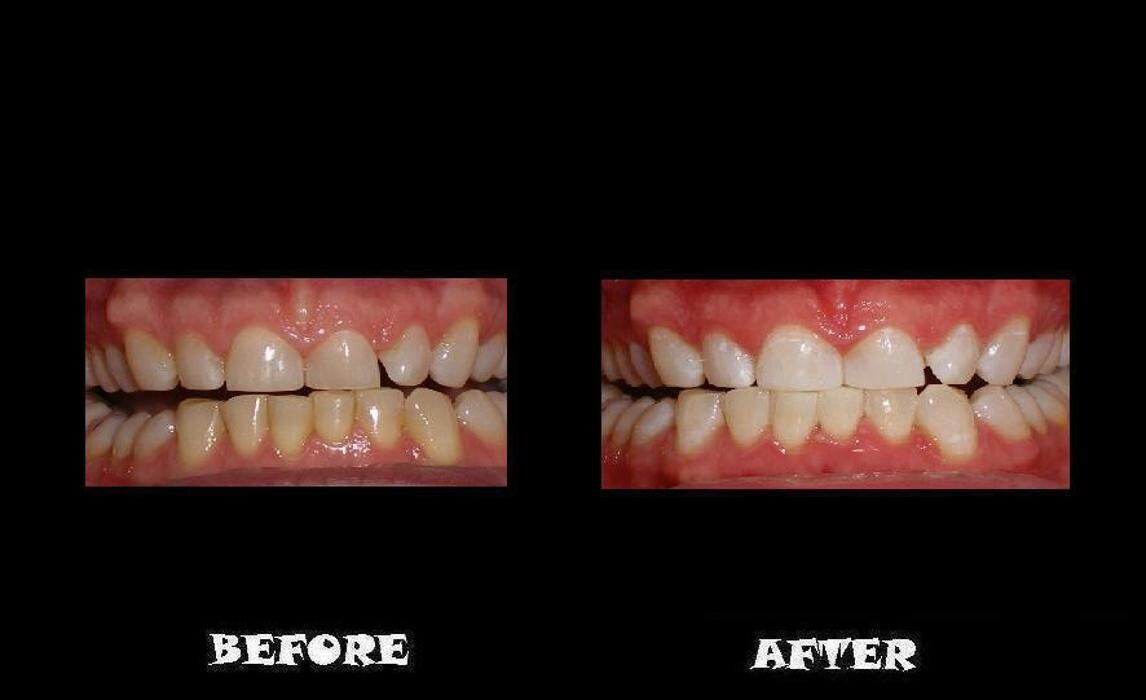 Images Designer Smiles