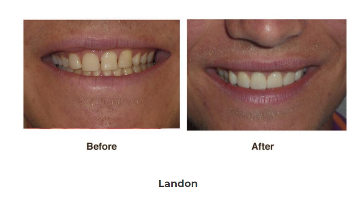 Images Designer Smiles