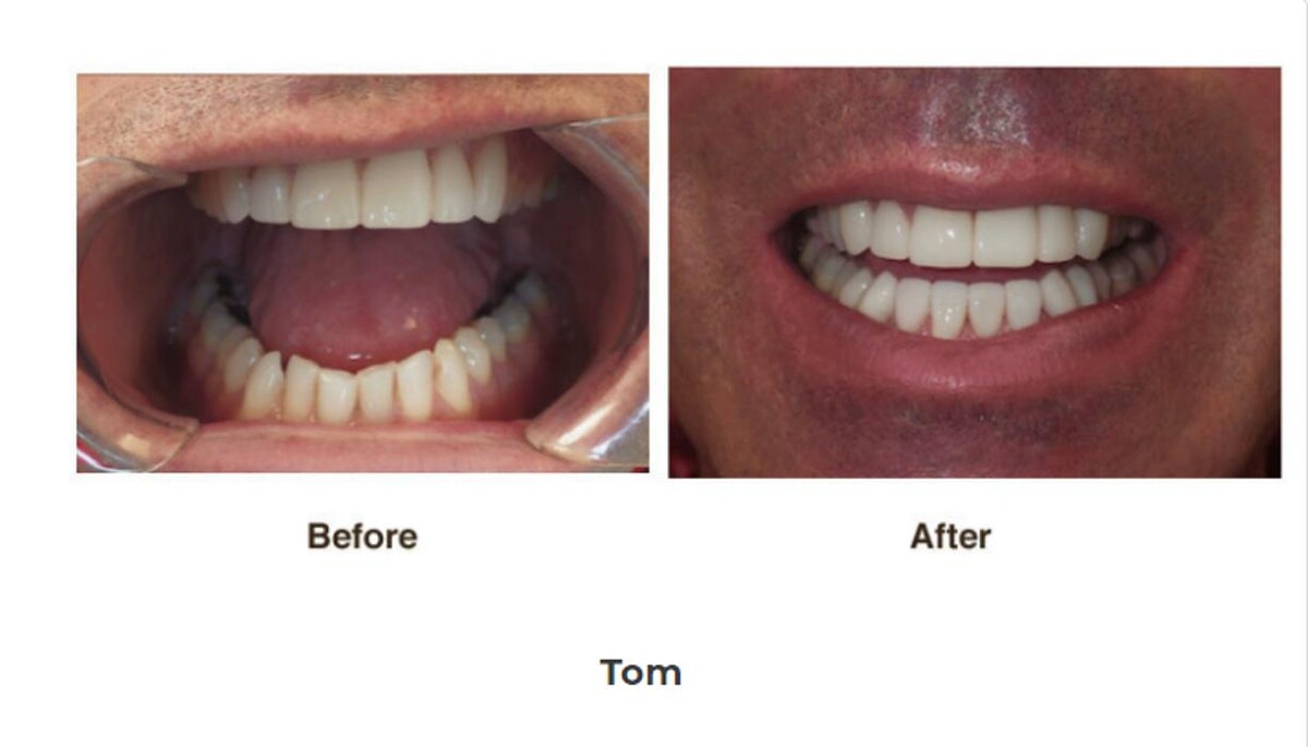 Images Designer Smiles