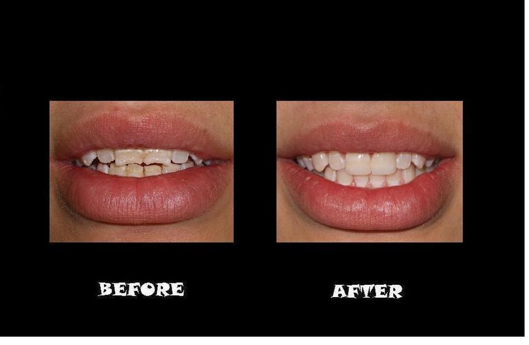 Images Designer Smiles