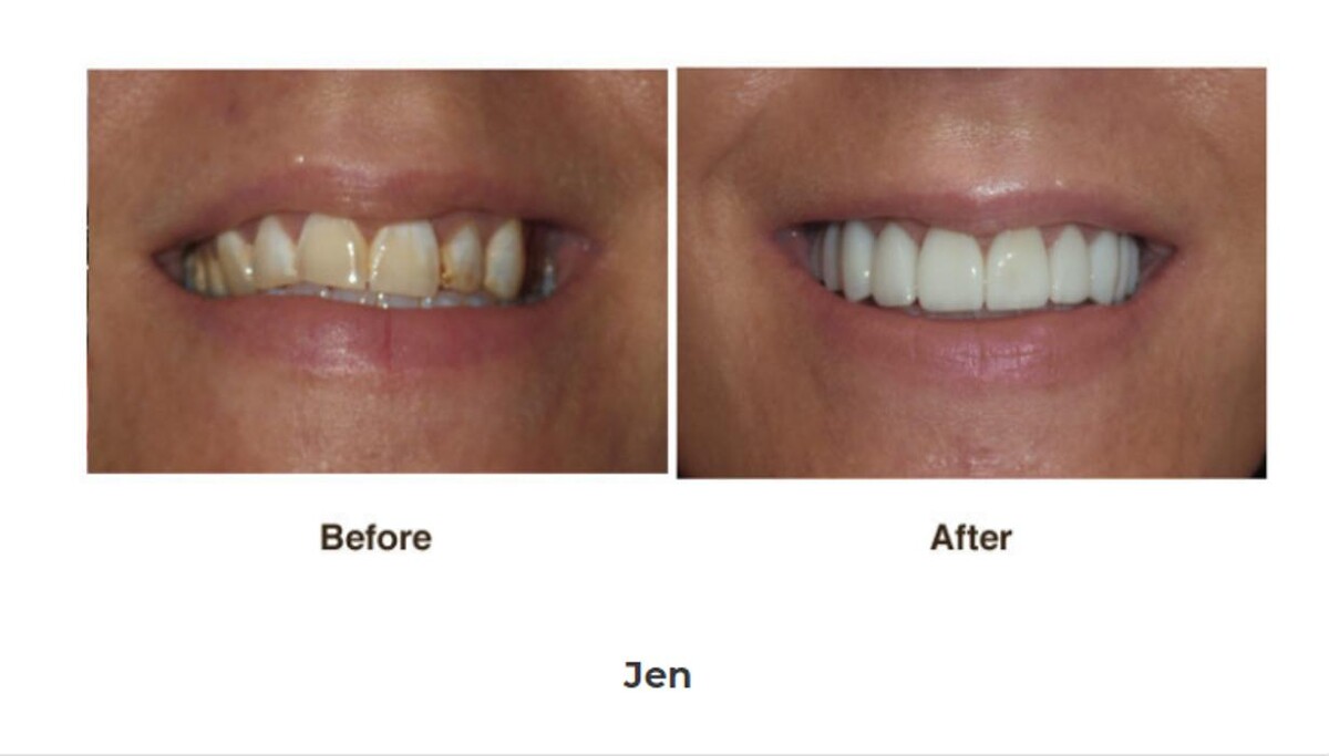 Images Designer Smiles