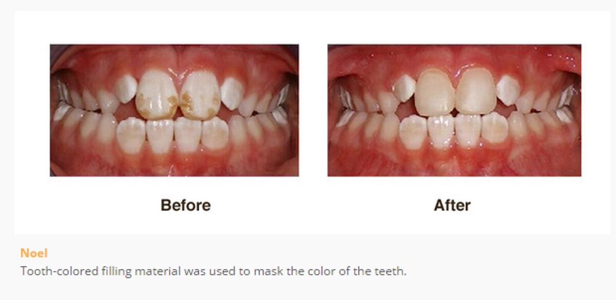 Images Designer Smiles