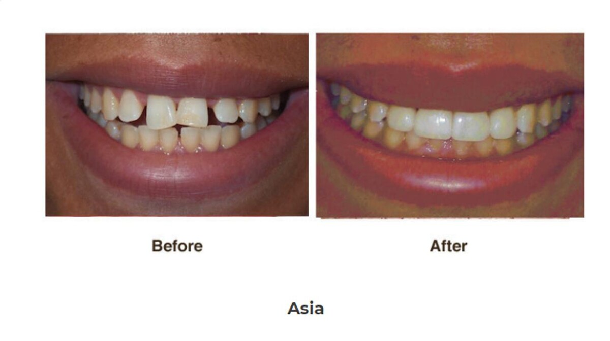 Images Designer Smiles