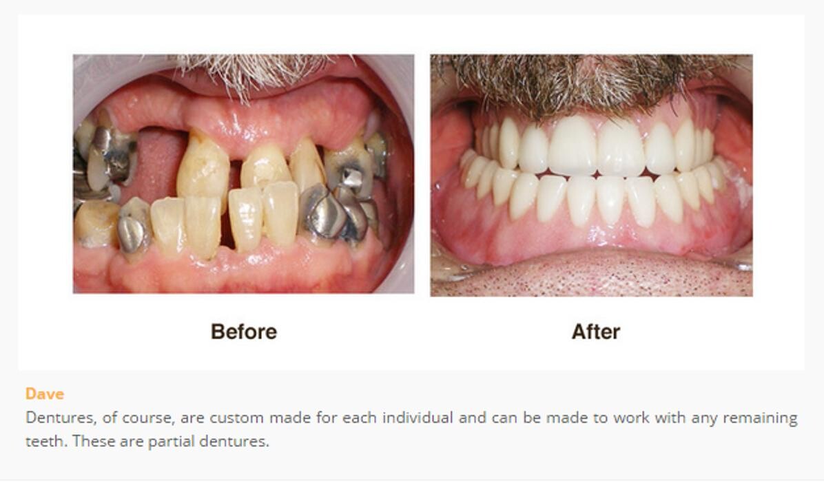 Images Designer Smiles