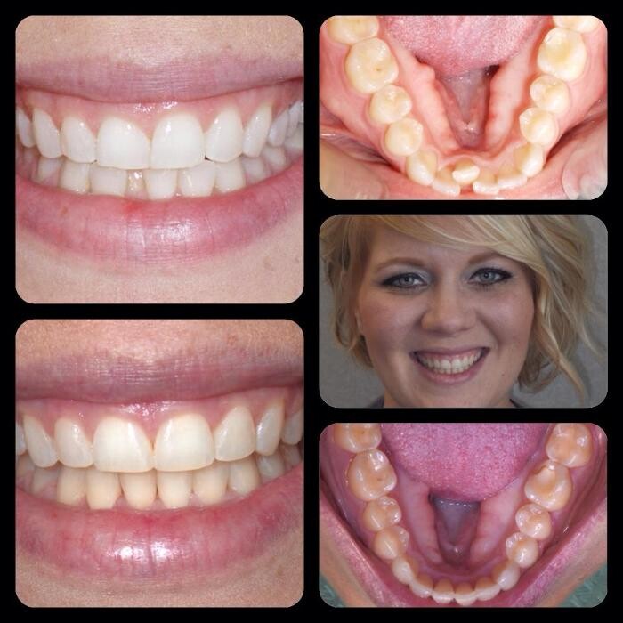 Images Designer Smiles