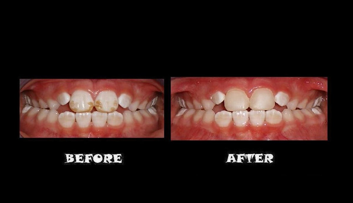 Images Designer Smiles