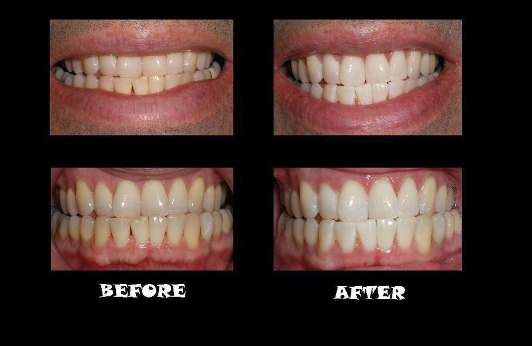 Images Designer Smiles