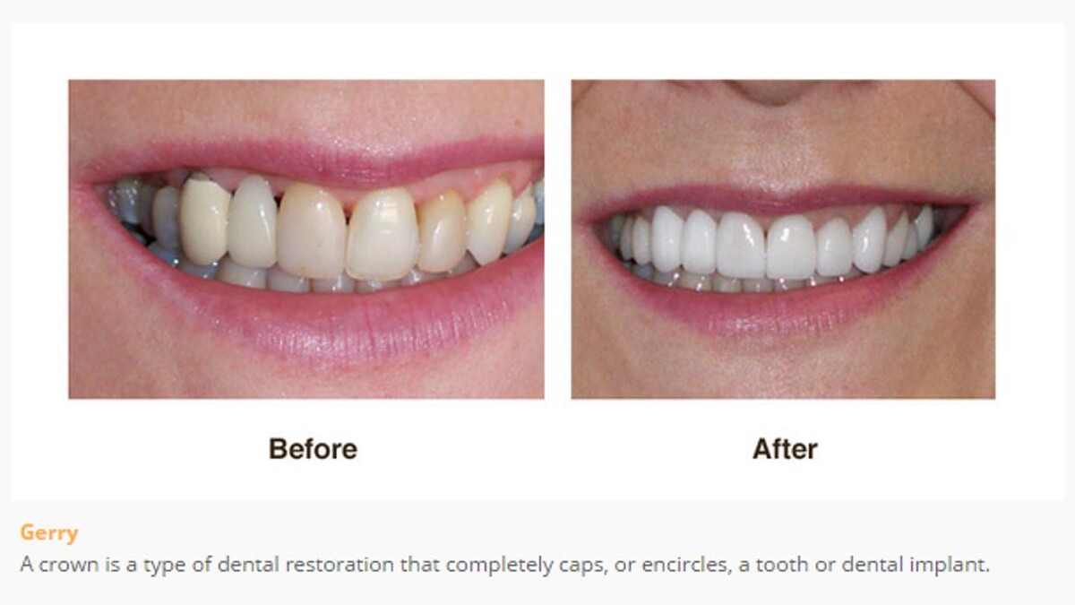 Images Designer Smiles