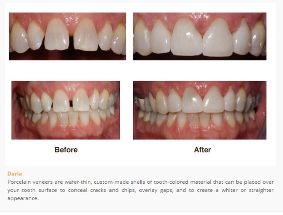 Images Designer Smiles