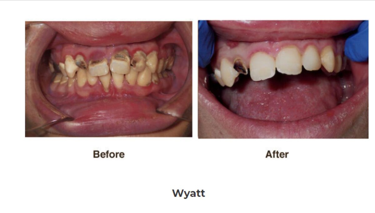 Images Designer Smiles