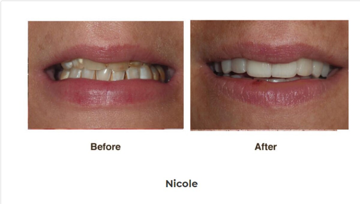 Images Designer Smiles