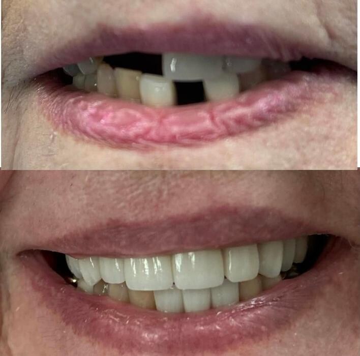 Images Michael W. King DDS