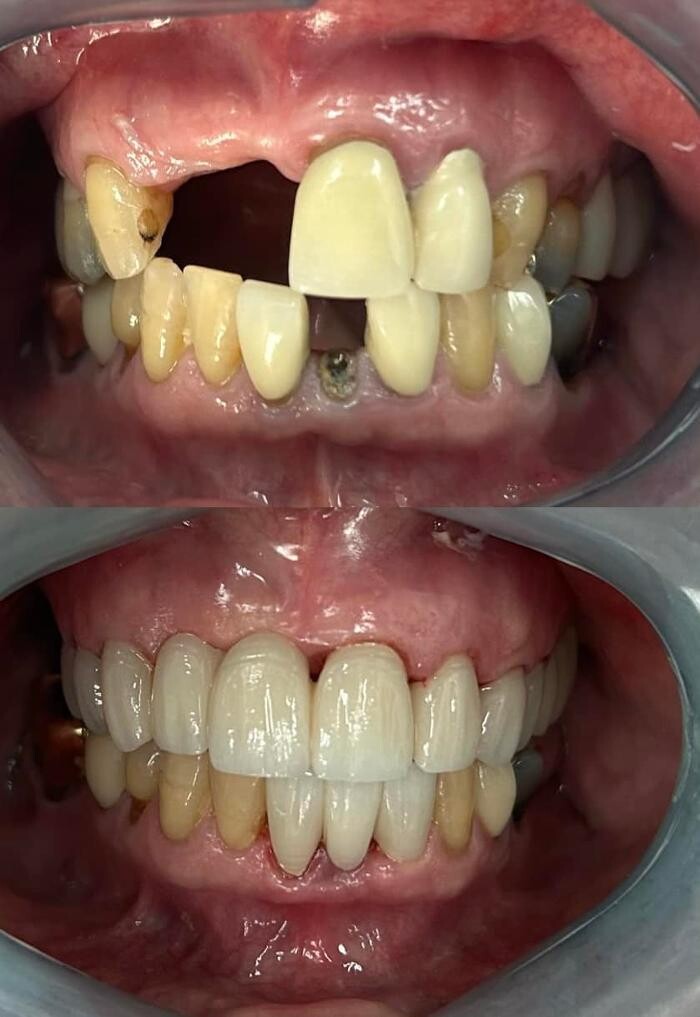 Images Michael W. King DDS