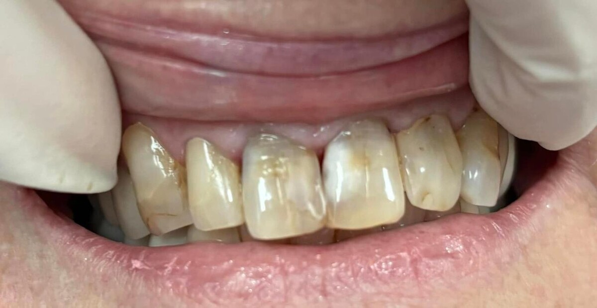 Images Michael W. King DDS