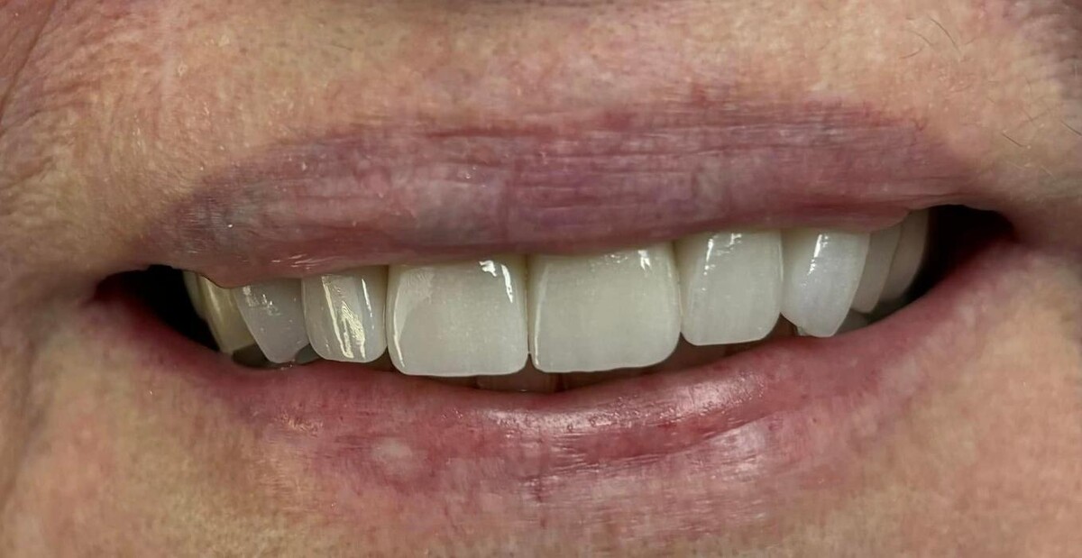 Images Michael W. King DDS