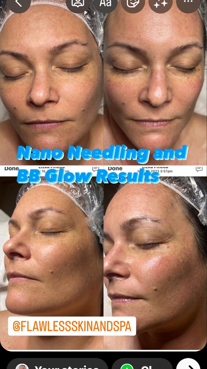 Images Flawless Skin & Spa