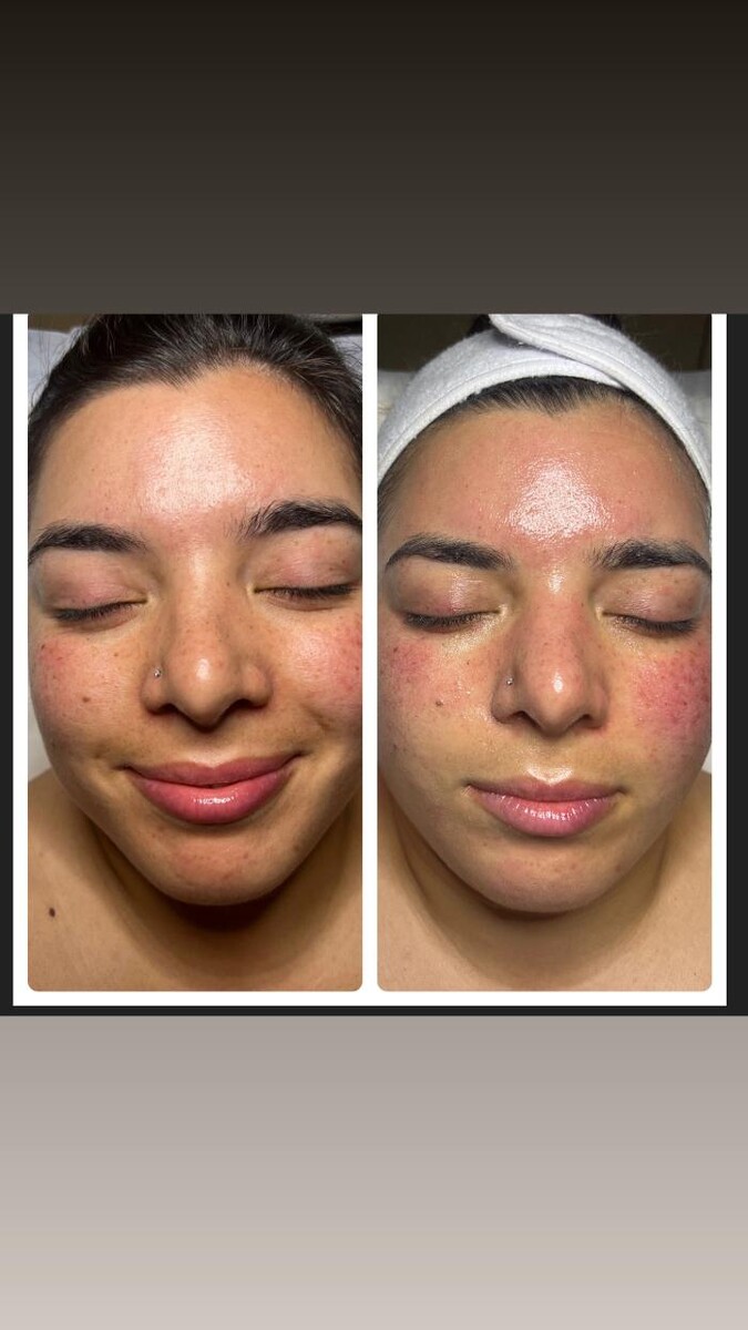 Images Flawless Skin & Spa