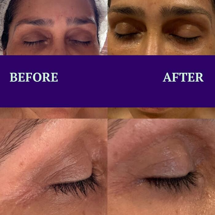 Images Flawless Skin & Spa