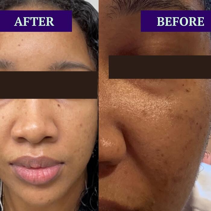 Images Flawless Skin & Spa