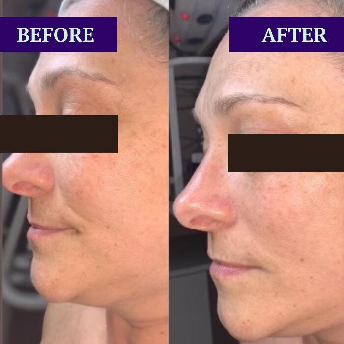 Images Flawless Skin & Spa