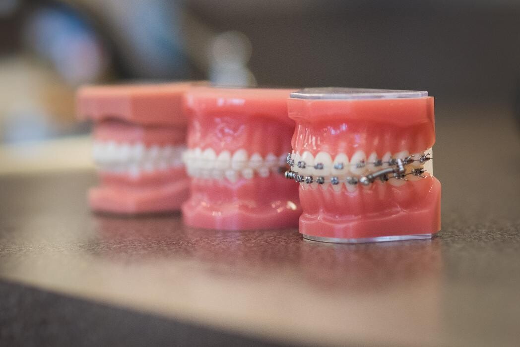 Images Roeder Orthodontics