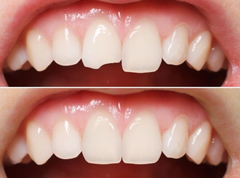 Images Drs. Jessica J. Johnston, DDS & Brent Charles Alexander, DDS