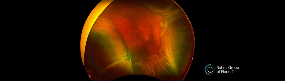 Images Retina Group of Florida