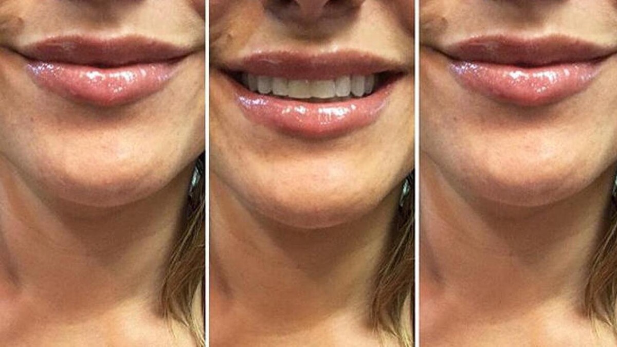 Images Miami Center for Dermatology