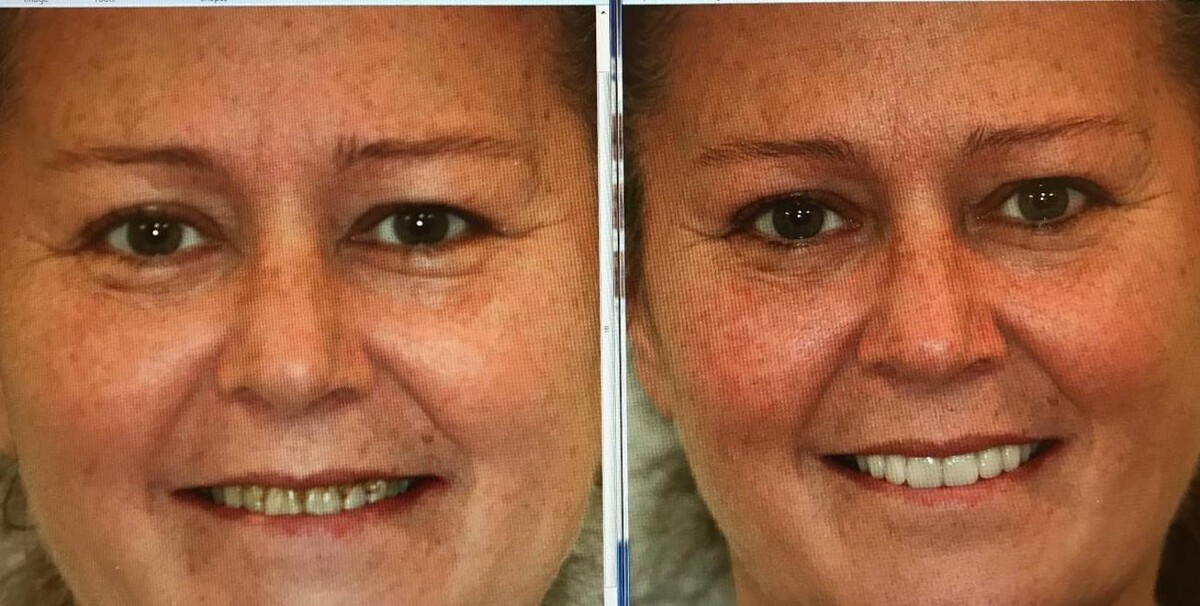 Images Brad Pitts Family & Cosmetic Dentistry