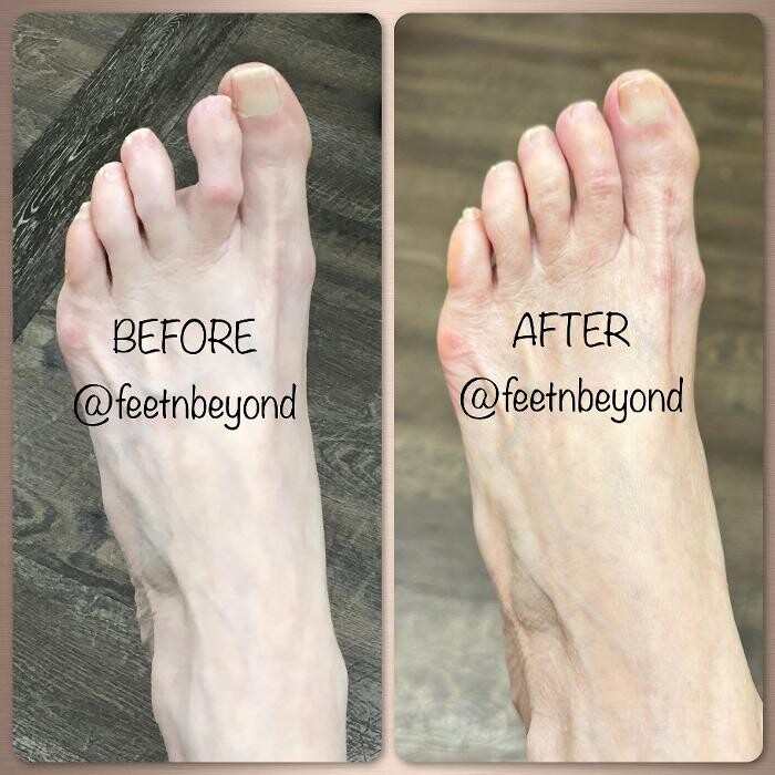 Images Feet 'N Beyond