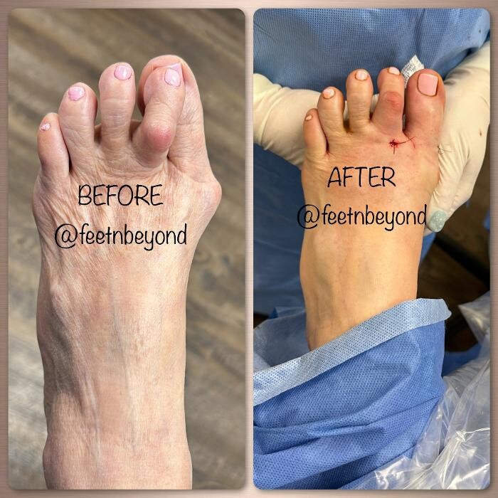 Images Feet 'N Beyond