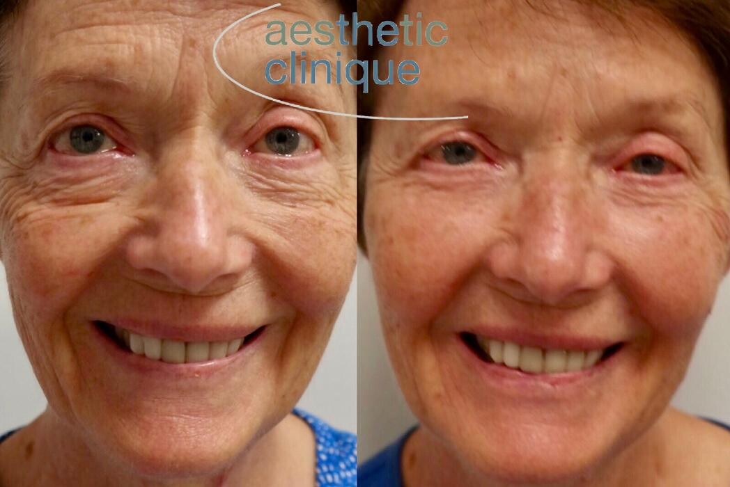 Images Aesthetic Clinique