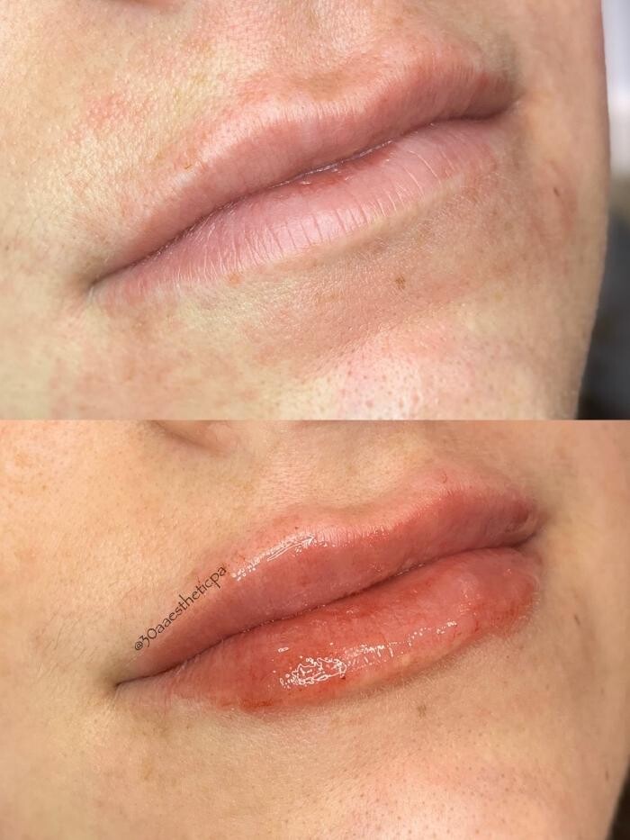 Images Aesthetic Clinique