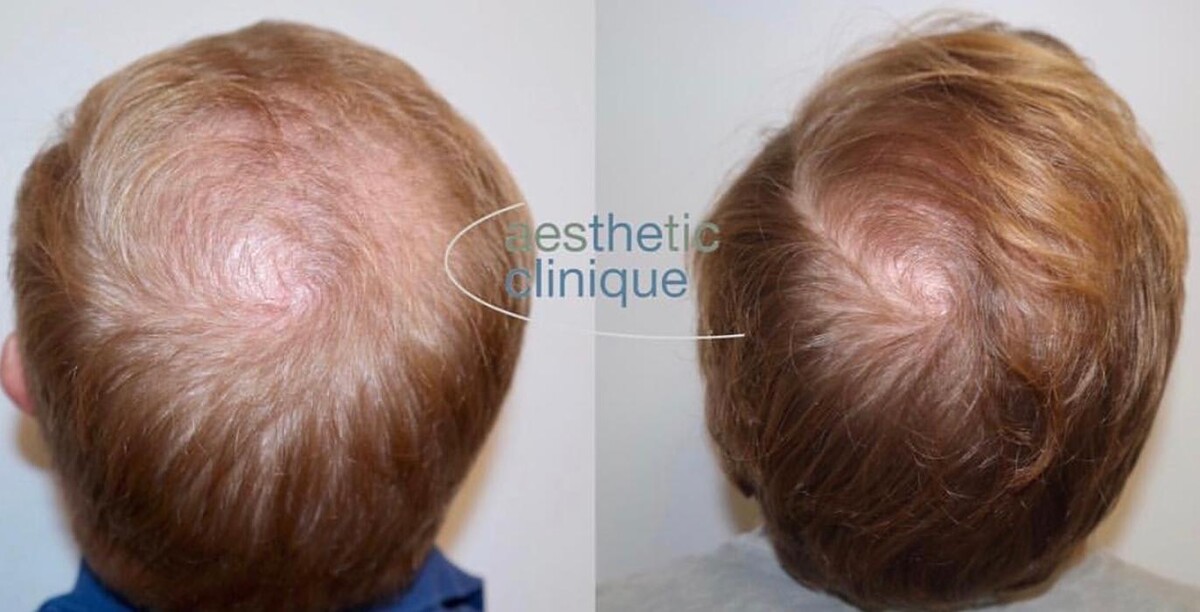 Images Aesthetic Clinique