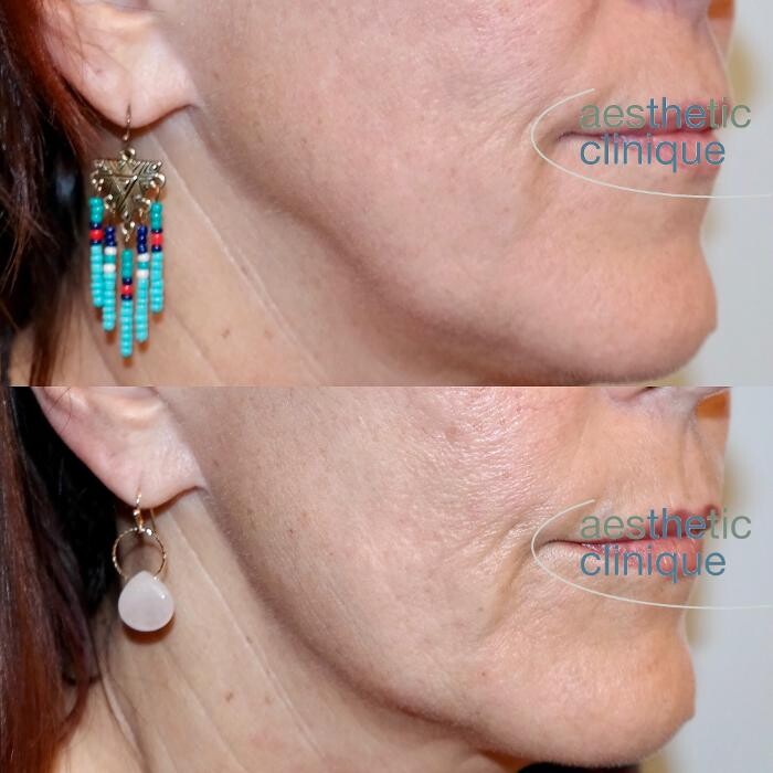 Images Aesthetic Clinique